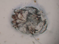 scabies mites